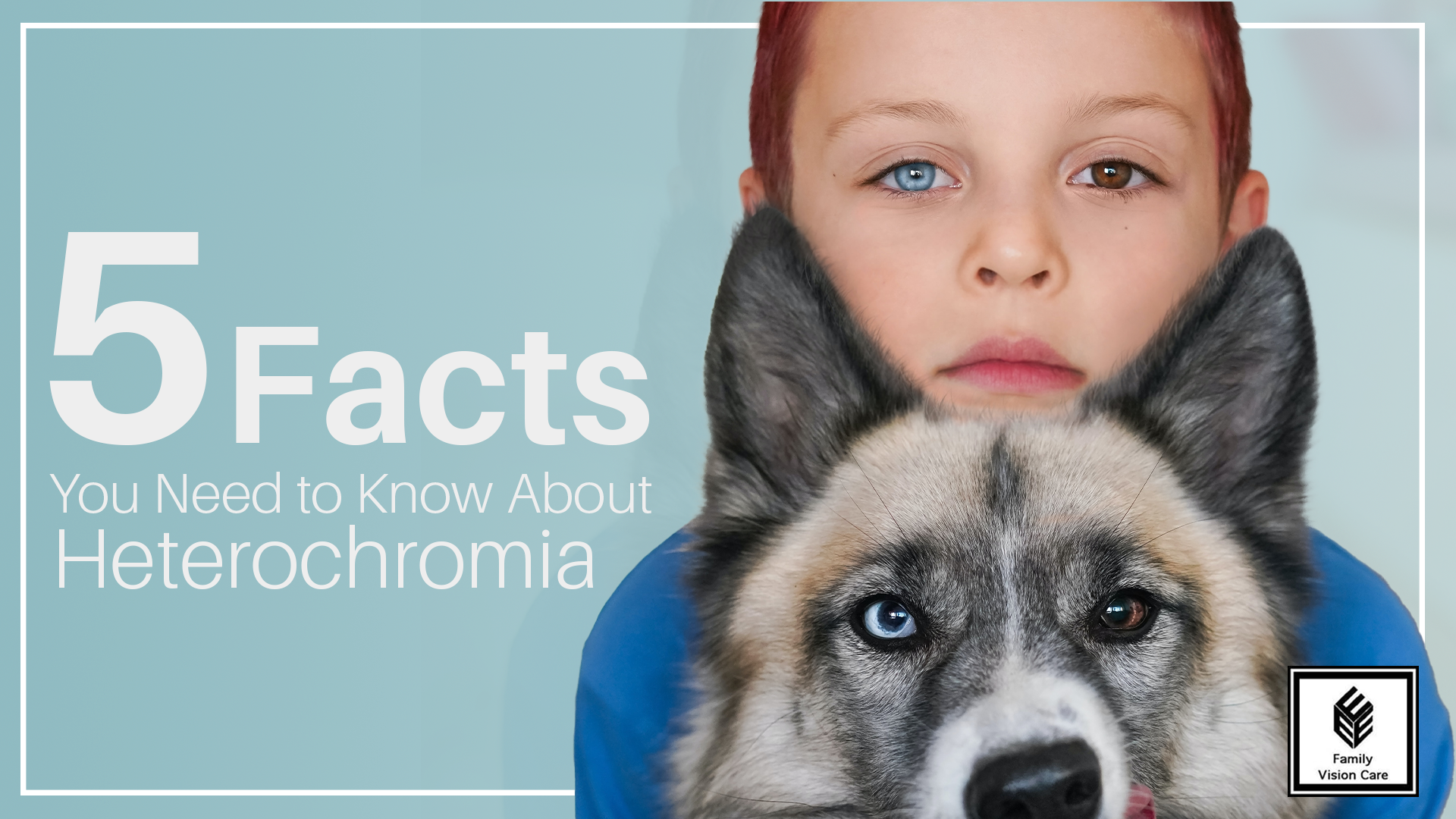 Heterochromia Facts for Kids